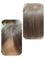 ユーフォルムギンザ(y-Forme Ginza)&nbsp;話題のトキカタ♪前髪編