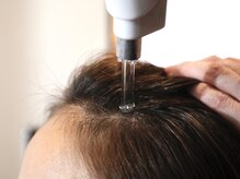 ルーツ バイ リズム(root by r-ism)の雰囲気（最新《エア・インジェクション》ヒト幹細胞を頭皮の奥まで届ける）