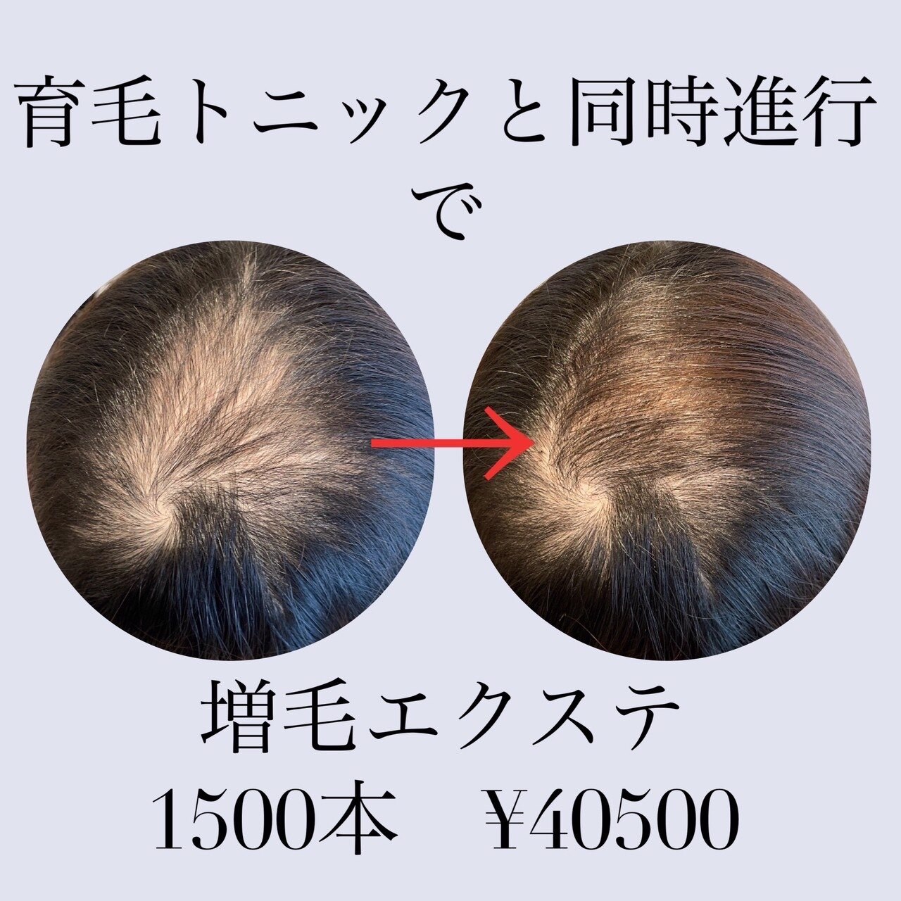 増毛エクステ800本：L258799598｜増毛エクステ専門店 エクステルーム