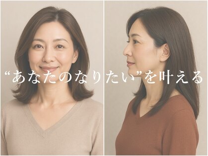 エタンセル(Etincelle)の写真