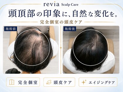レヴィア(revia)の写真