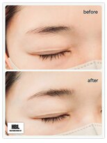 グランドール リュクス(Grandoll Luxe)&nbsp;ハリウッドブロウリフト