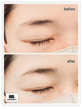 グランドール リュクス(Grandoll Luxe) ハリウッドブロウリフト