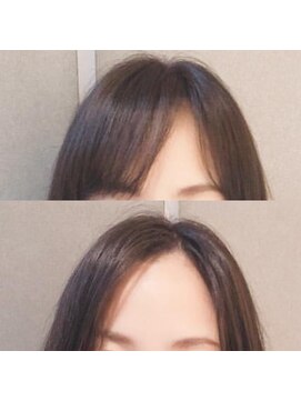 アフィーロ(ACHFILO) 前髪エクステ