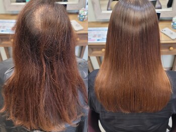 アノネ 熊の前店(anone)の写真/髪の広がりやうねり・癖が気になる方にも◎高濃度水素ストレートで潤いのあるまっすぐなまとまる髪質に！