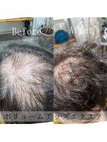 ツムグ 代官山店(TUMUGU)&nbsp;おとな女性髪悩み地肌みえ解消ボリュームアップエクステ】500本