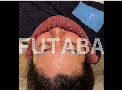フタバの写真