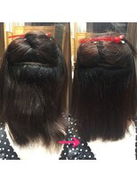 ロアナ 六本木(LOANA ROPPONGI)&nbsp;酸性矯正で負担を少なく施術