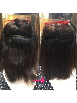 ロアナ 六本木(LOANA ROPPONGI) 酸性矯正で負担を少なく施術