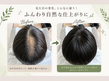 ビューティーアンドオン 西葛西 葛西(beauty.And On)