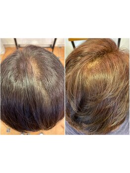 【都立大学駅徒歩5分】エリアで希少なオーガニックカラー/ヘナ取り扱いサロン◇頭皮に優しい白髪ぼかしも◎