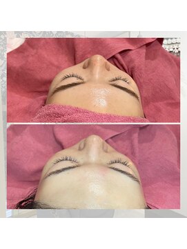 ヘアメイクエコー hair make echo レディースシェービング