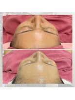 ヘアメイクエコー hair make echo&nbsp;レディースシェービング