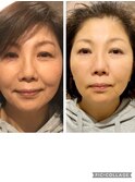 【大口式筋膜ヘッドスパ】名古屋の美容室actif 頭皮改善/ MJ有紀