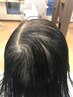 薄・毛　に悩んだらコチラ！【来店後メニューを決めていただけます】