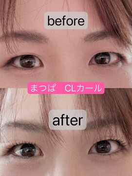 アローズ(arose) まつぱ