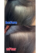 美容室 ココ COCO&nbsp;育毛促進