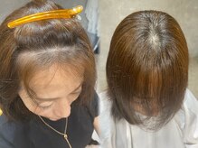 《エンジェリックケア》前髪割れ気になりませんか？そのお悩みエンジェリックケアで解消できます！