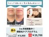 【夏本番前に】短期集中！男顔つるつるプログラム体験¥11000→¥9900