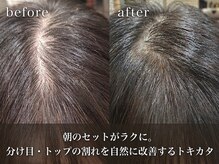 ロンロンシャ 都ホテル店(RONRONCHAT)の雰囲気（諦めていた「生えグセ」を根本解決。魔法の技術TOKIKATA導入店）