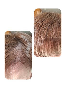 ユーフォルムギンザ(y-Forme Ginza) 話題のトキカタ♪前髪編