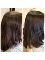 ヘアーサロン リベーラ(Hair Salon Libela)&nbsp;乾燥で気になるお悩みも解決し、毛根から生えてくる毛も綺麗に