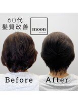 ムーン(moon) 頭皮改善&髪質改善ケア　60代の変化