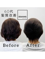 ムーン(moon)&nbsp;頭皮改善&髪質改善ケア　60代の変化