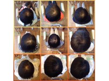ブブグラスヘアーの雰囲気（髪の毛促進ヘッドスパも好評です（約６ヶ月後）左上から右下です）