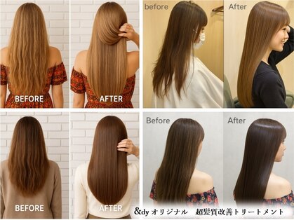 アンディー(&dy)の写真