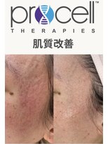 サロン モーリー(salon morley)&nbsp;プロセルセラピーズ 頭肌質改善トリートメント