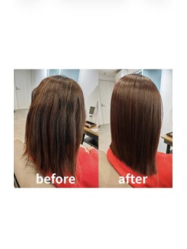 エイジングケア