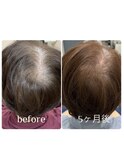 【強髪で白髪予防】