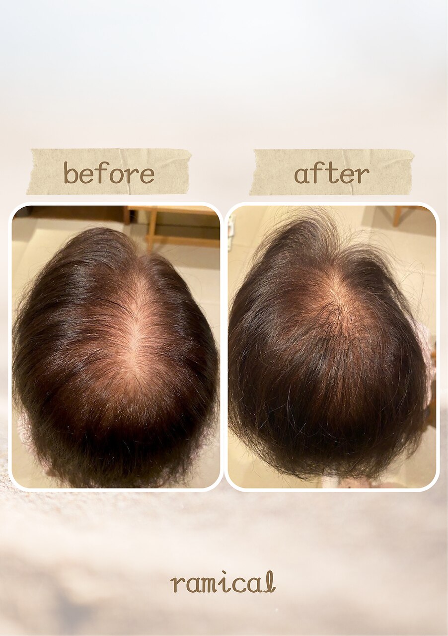 ヘアループ 増毛エクステ500本：L267530019｜ラミカル(ramical)のヘア