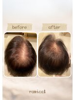 ラミカル(ramical)&nbsp;ヘアループ　増毛エクステ
