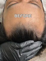 ライズヘアーバズ(RAIZE HAIR BUZZ) スカルプインク