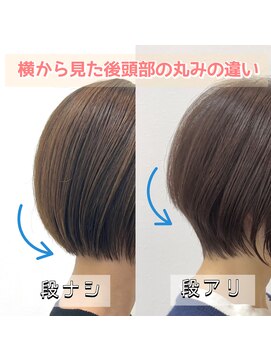 テルミークリニカルデザイン 千里中央店 ショートとショートボブの丸み比較くびれ比較