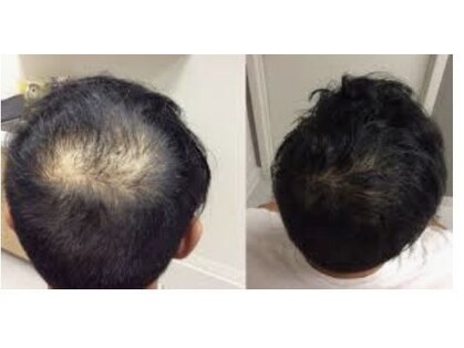 ライフステージ(Life Stage)の写真