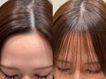 前髪の生え癖改善クロスパーマ○長年のお悩み解決します