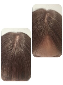 ユーフォルムギンザ(y-Forme Ginza) 話題のトキカタ♪前髪編