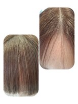 ユーフォルムギンザ(y-Forme Ginza)&nbsp;話題のトキカタ♪前髪編