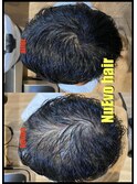 scalp care ～before after～
