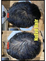 ヌエボヘアー(NuEvo hair) scalp care ～before after～