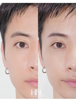 はな(hana)の写真/理想の眉毛へ導く新アイブロウメニュー！顔周りカット×前髪で垢抜け◎メンズはパーマとセットでお得