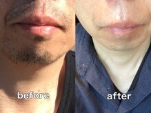 ヘアアンドメイクレイズ(HAIR&MAKE raise)の雰囲気（髭脱毛で忙しい朝の髭剃り時間を短縮！肌への負担も軽減♪）