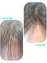 ユーフォルムギンザ(y-Forme Ginza)&nbsp;話題のトキカタ♪前髪編