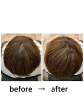 【根本的な改善には継続を】まずは半年～１年続けていきましょう。