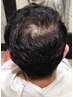 【男性限定】丁寧カウンセリング+似合わせカット+ブロンズコース500本