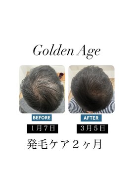 ゴールデンエイジ(Golden Age) 【　発　毛　ケ　ア　２ヶ月】