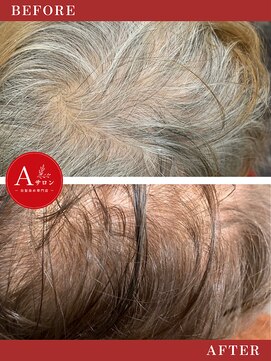 エーサロン(Aサロン) 根元染め/白髪染め